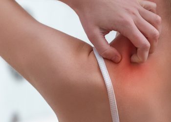 6 doenças do verão para ficar de olho e como evitá-las