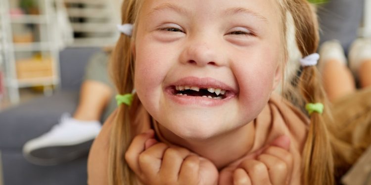 Como acolher o diagnóstico de Síndrome de Down e apoiar o desenvolvimento da criança?