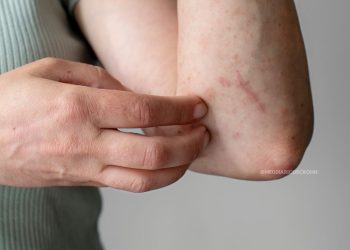 Quando o corpo muda depois de um diagnóstico!